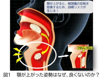 コラム 食事介助のポイント スプーンの大きさで食べ方が変わる 介護食のメディケア食品 マルハニチロ